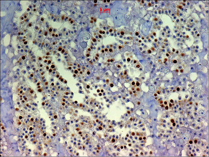 Figure 4: BrdU staining in sponge (Halisarca caerulea) using MUB0200P (clone IIB5)